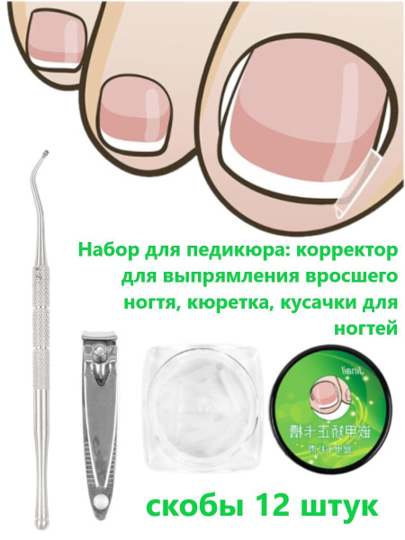 Корректор от вросшего ногтя ped5 - купить по выгодной цене в интернет ...
