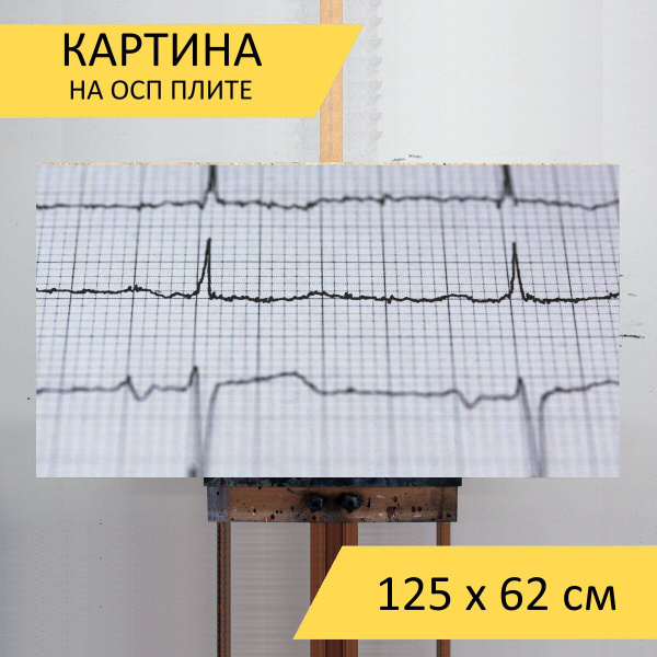 Картина "Экг, электрокардиограмма, медицина" для интерьера на стену ...