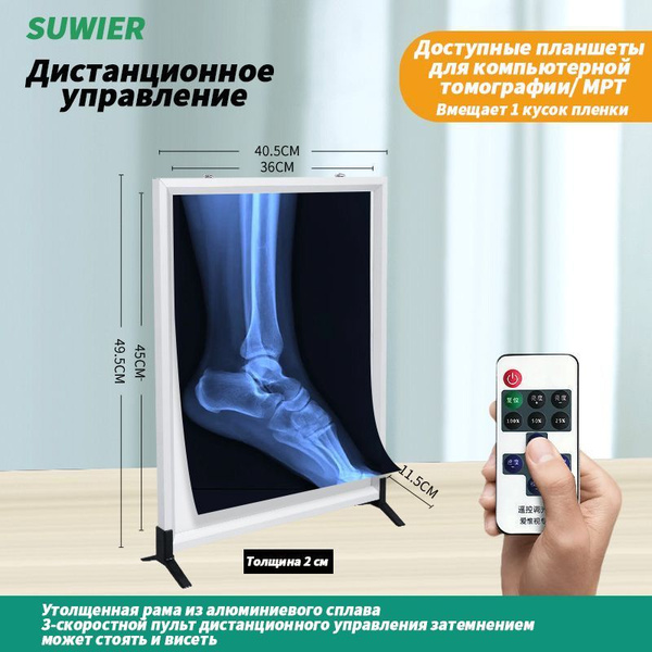 Негатоскоп для рентгеновских снимков с дистанционным управлением /для ...