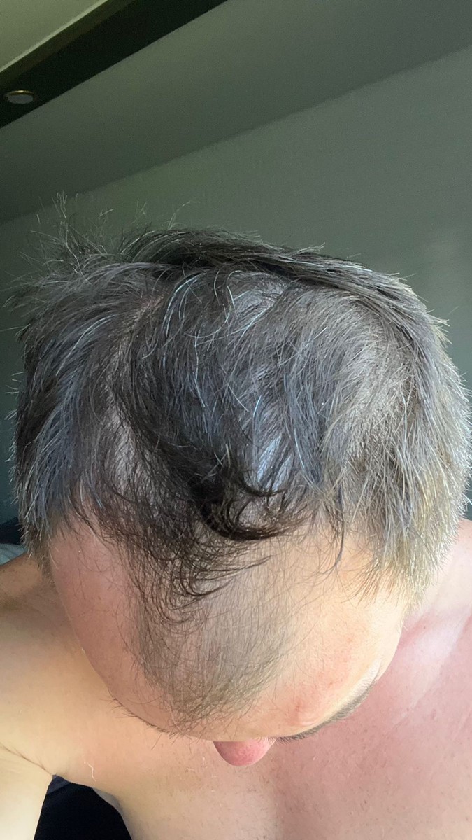 Вот до и после использования, разница ощутимая.